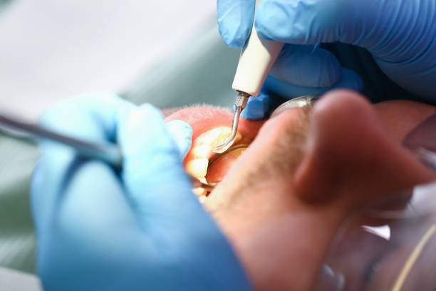 Best Weekend Emergency Dentist in Cardington, OH